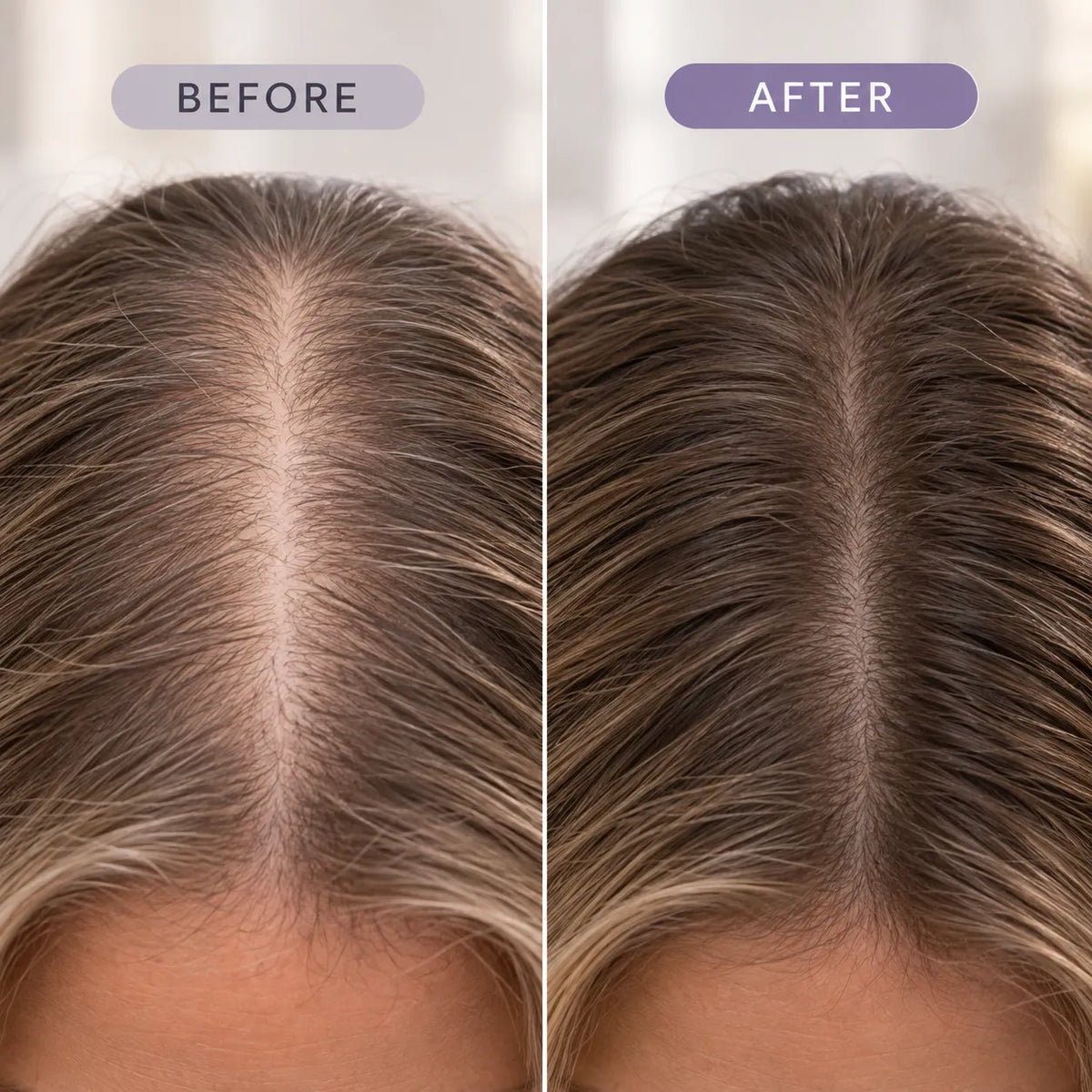 LUMEA Revive™ Scalp Roller